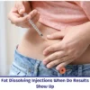 Fat Dissolving Injections When Do Results Show Up